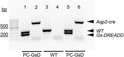 Stimulation of the Epithelial Na+ Channel in Renal Principal Cells by Gs-Coupled Designer Receptors Exclusively Activated by Designer Drugs